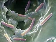 تحقیق بررسی اشریشیا کولی اشریشیا کولی Escherichia coli