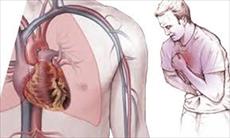 پاورپوینت دارو درمانی بیماری قلبی- عروقی آنژین صدری